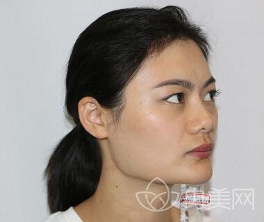 北京金燕子医疗美容价格表全新版发布