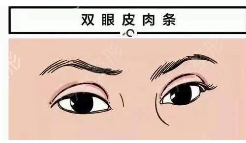 北京超牛双眼皮医生排行榜TOP4