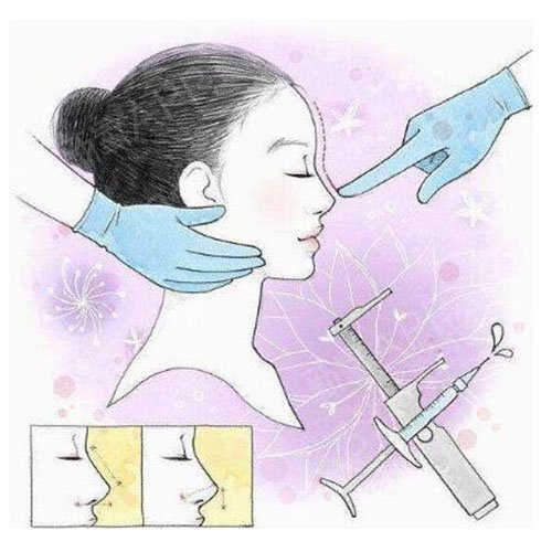长沙叶子整形医院隆鼻好不好
