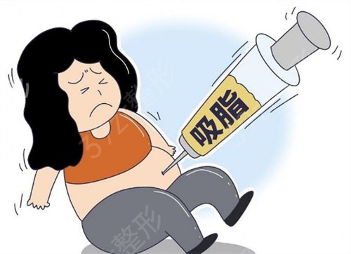 成都抽脂手术好的医院推荐这几家