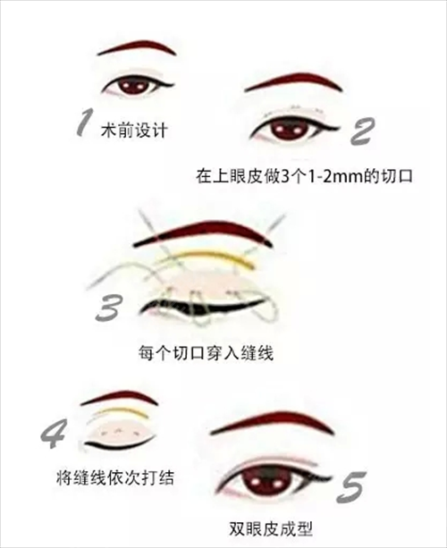 武汉医美整形医院排名榜4大知名机构揭晓