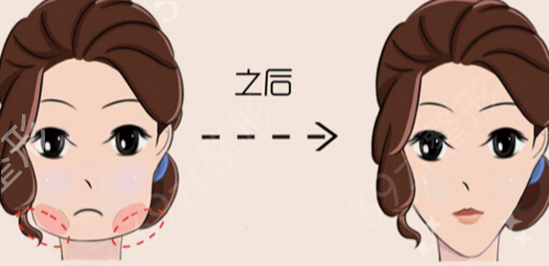 杭州有名的公立三甲整形医院是哪些
