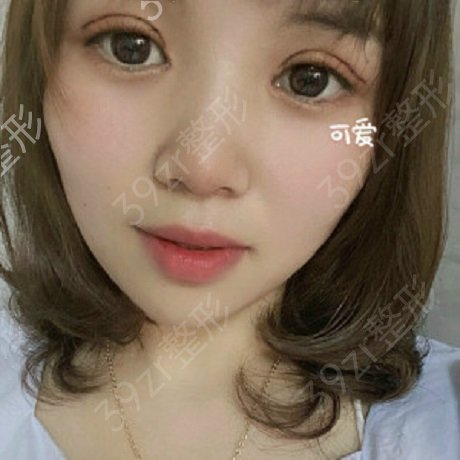 北京301医院和八大处整形科哪个双眼皮好