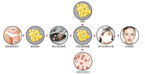 上海九院脂肪填充全臉哪個醫(yī)生好