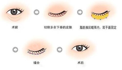 兰大二院美容科pk兰州陆军总院美容科哪个好
