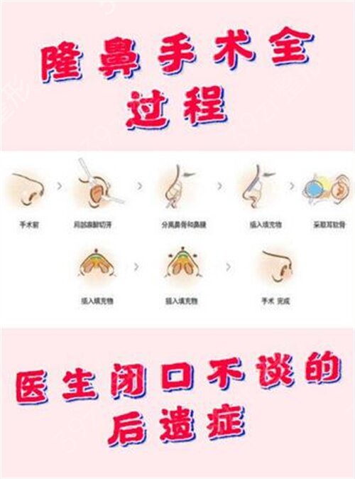 昆明隆鼻哪家好