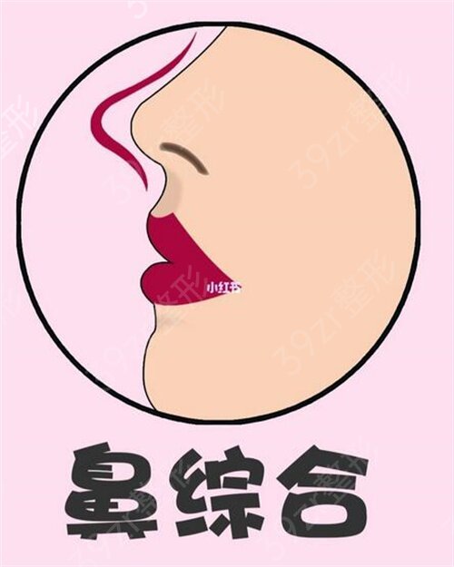 南宁隆鼻整形医院排名榜正式发布_口碑案例及手术价格免费查询