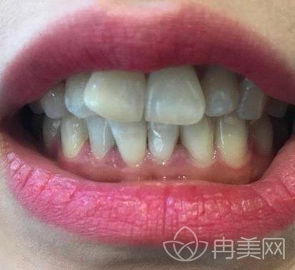 廣大口腔醫(yī)院是三甲醫(yī)院嗎