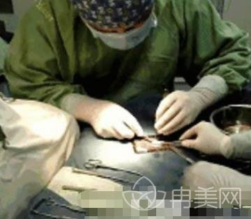2022邯鄲市第三醫(yī)院整形美容科隆鼻修復(fù)案例_價格表新版_口碑