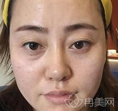 石家莊260醫(yī)院整形科怎么樣