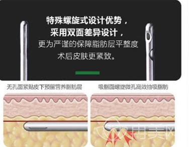 哈爾濱吸脂哪個(gè)醫(yī)院好