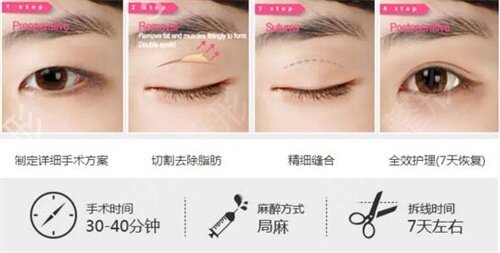 薛旦双眼皮