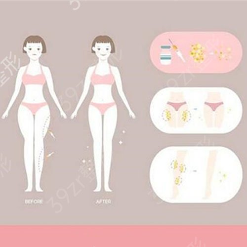 广州星团整形医院怎么样