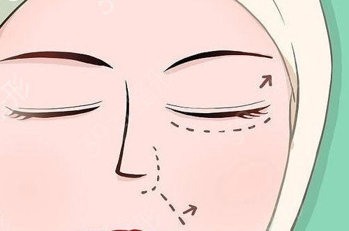 浙醫(yī)一院整形科雙眼皮價(jià)格表上線