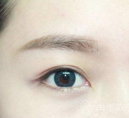 南京雙眼皮整形醫(yī)院比較好的有哪些