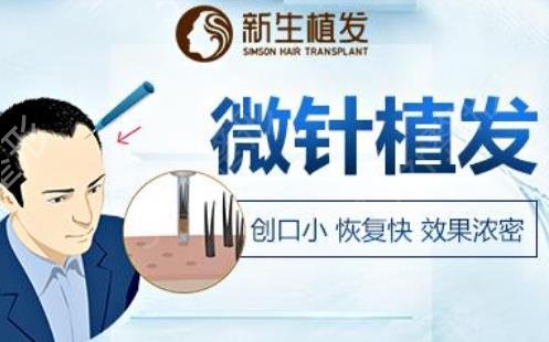 广州植发公认好的医院排名前十