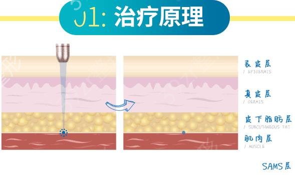 2022重庆热拉提(拉皮)整形美容医院排名前十