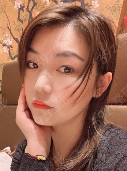 成都热玛吉哪些医院可以做