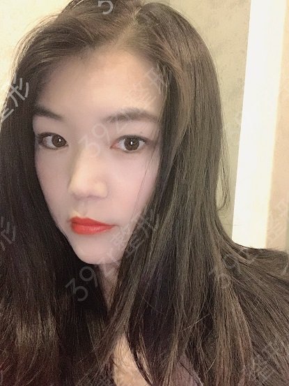 成都热玛吉哪些医院可以做