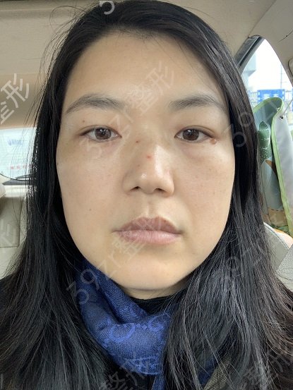成都热玛吉哪些医院可以做