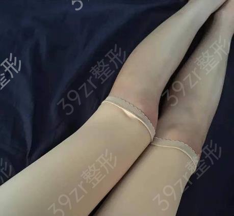 重庆军科和军美哪个医院好