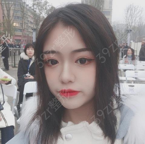 上海整形公立三甲医院排名前三的哪家好
