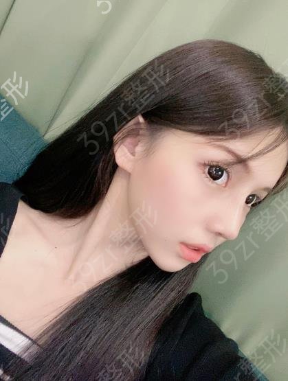 华西医院隆鼻好的医生是谁