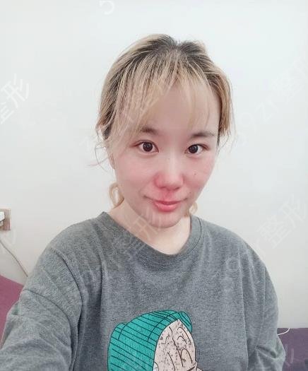 北京八大处谁垫下巴好