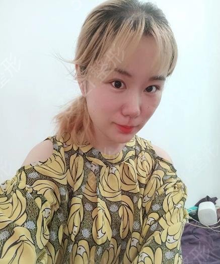 北京八大处谁垫下巴好