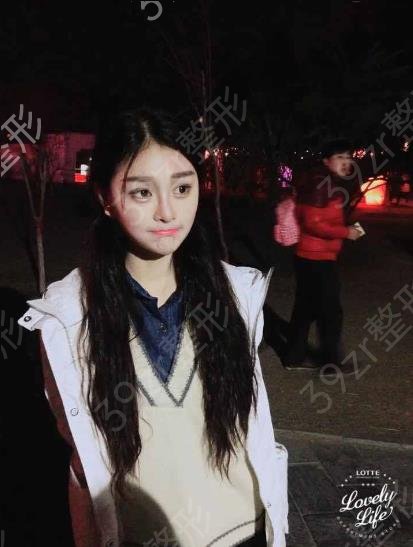 杭州假体隆鼻医院哪家好