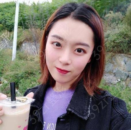 沈阳杏林张莹莹和房红超双眼皮哪个好