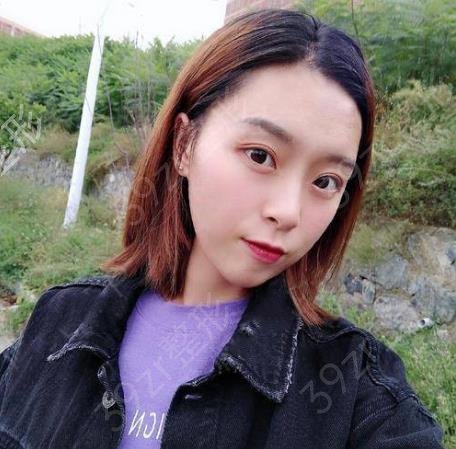 沈阳杏林张莹莹和房红超双眼皮哪个好