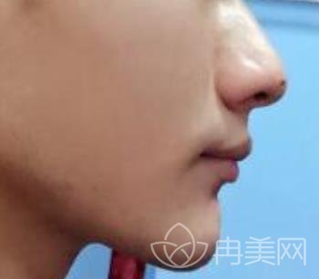 邯郸三院牙齿矫正怎么样