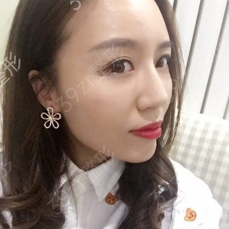 2022北京脂肪填充专家排名榜