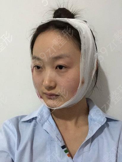 上海四大磨骨整形医院排名榜权威揭晓