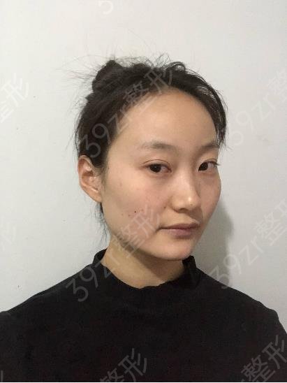上海四大磨骨整形医院排名榜权威揭晓