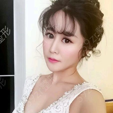 北京热玛吉认证医生名单查询_排名榜前四强专家揭晓