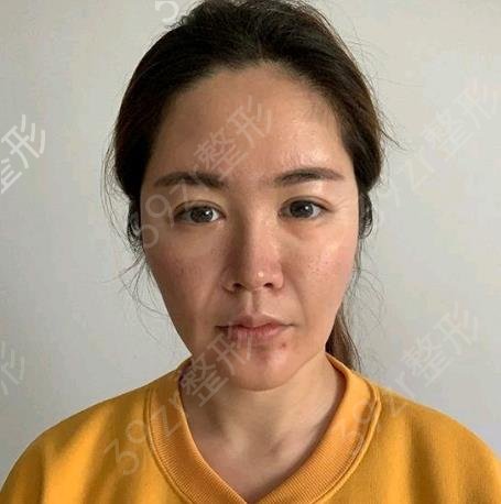 北京热玛吉认证医生名单查询_排名榜前四强专家揭晓