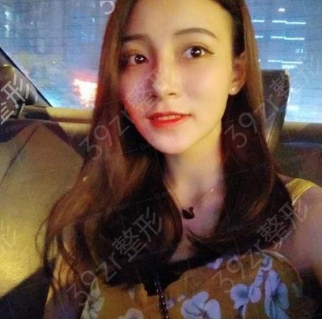 北京沃尔刘彦军鼻修复多少钱