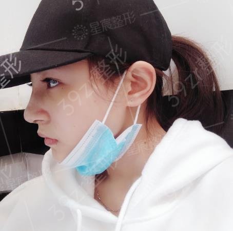北京沃尔刘彦军鼻修复多少钱