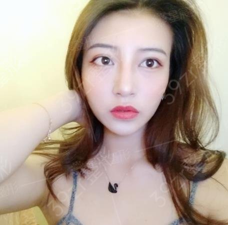 北京沃尔刘彦军鼻修复多少钱