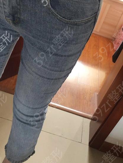 杭州整形医院排名前三名次更新