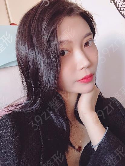 合肥做双眼皮好的整形医院推荐