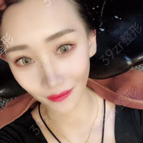 深圳面部脂肪填充专家排名榜