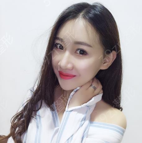 深圳面部脂肪填充专家排名榜