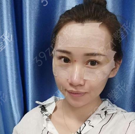 深圳面部脂肪填充专家排名榜