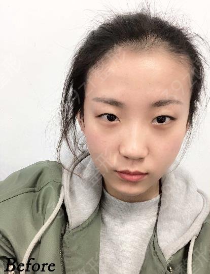 成都做眼部手术整形医院排行榜