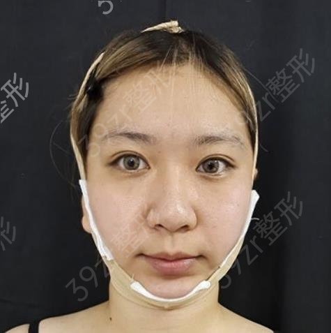 上海首尔丽格磨骨哪个医生好