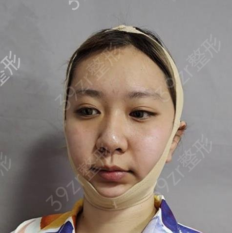上海首尔丽格磨骨哪个医生好
