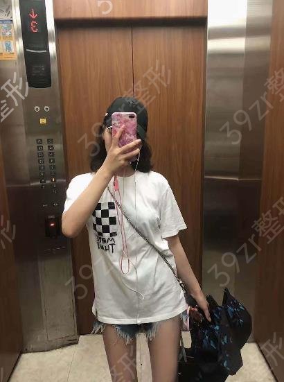 杭州哪家医院抽脂好